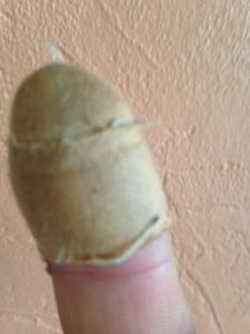 Damaged Digit